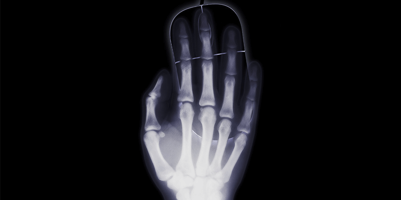 Osteomyelitis